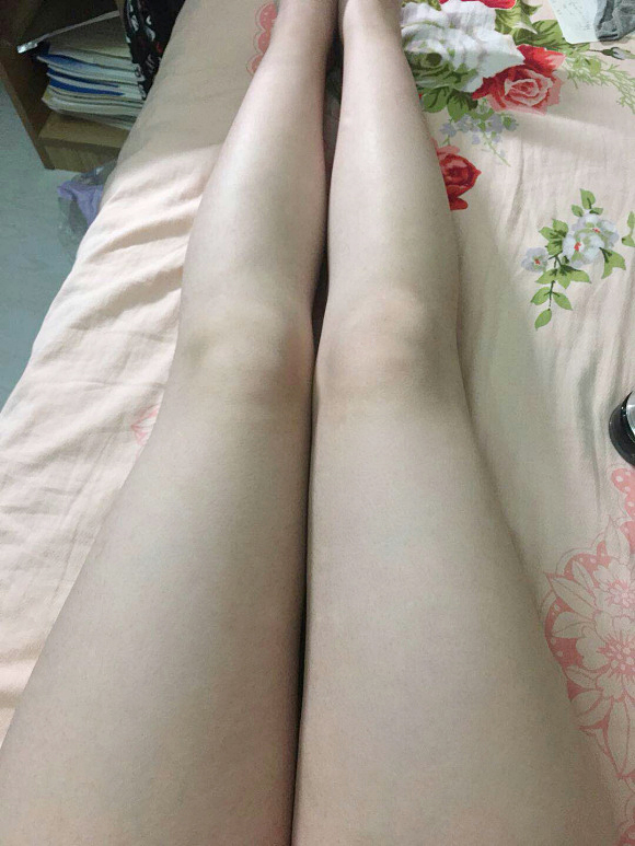 简晴往事：鸡皮肤怎么消除最有效？教你一招去鸡皮肤方法！-第7张图片-灵芝大师