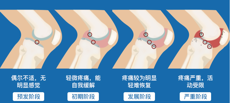 氨糖软骨素价格多少钱一盒?它居然是性价比最高的!-第1张图片-灵芝大师 氨糖软骨素价格多少钱一盒?它居然是性价比最高的!-第1张图片-灵芝大师