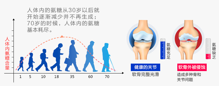 氨糖软骨素哪个牌子好?这四类人禁止服用!-第1张图片-灵芝大师 氨糖软骨素哪个牌子好?这四类人禁止服用!-第1张图片-灵芝大师