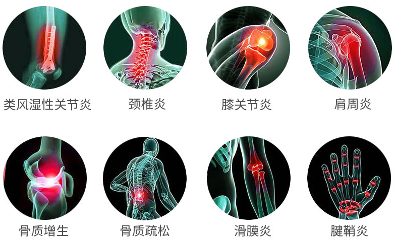 氨糖软骨素适用人群有哪些