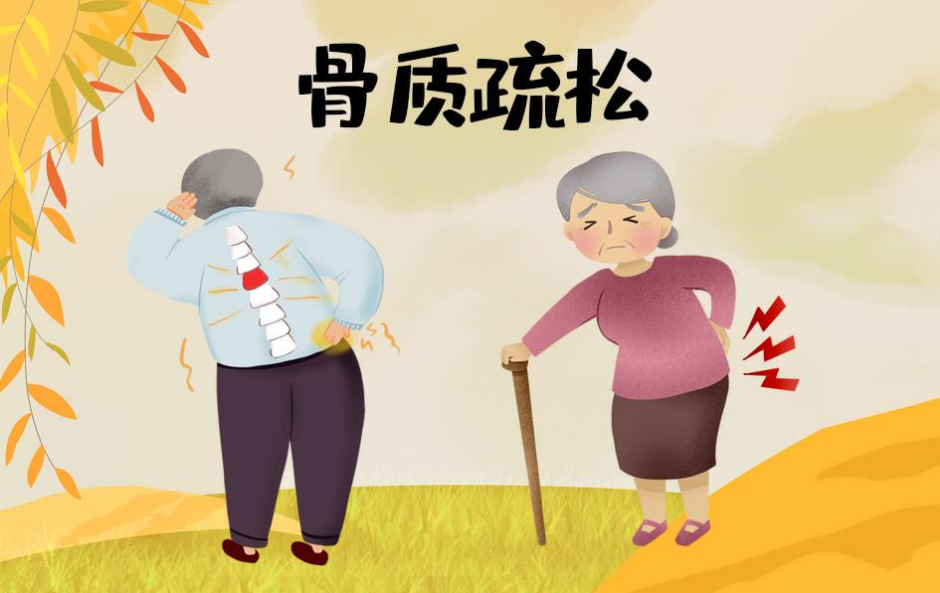 骨质疏松有哪些症状表现？教你轻松治疗骨质疏松