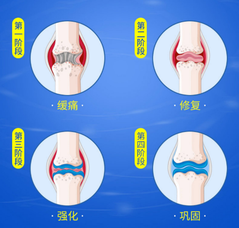 氨糖软骨素主要治什么?原来氨糖软骨素有这么多作用-第1张图片-灵芝大师 氨糖软骨素主要治什么?原来氨糖软骨素有这么多作用-第1张图片-灵芝大师