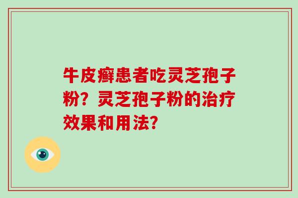 牛皮癣患者吃灵芝孢子粉？灵芝孢子粉的治疗效果和用法？