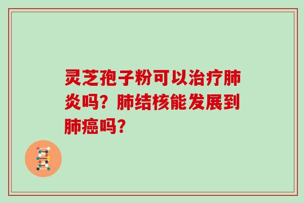 灵芝孢子粉可以治疗肺炎吗?肺结核能发展到肺癌吗?-第1张图片-灵芝大师 灵芝孢子粉可以治疗肺炎吗?肺结核能发展到肺癌吗?-第1张图片-灵芝大师