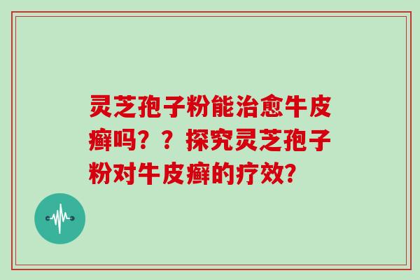 灵芝孢子粉能治愈牛皮癣吗??探究灵芝孢子粉对牛皮癣的疗效?-第1张图片-灵芝大师 灵芝孢子粉能治愈牛皮癣吗??探究灵芝孢子粉对牛皮癣的疗效?-第1张图片-灵芝大师