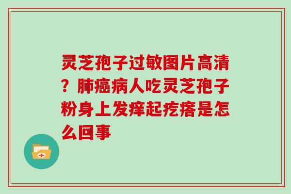 灵芝孢子过敏图片高清？肺癌病人吃灵芝孢子粉身上发痒起疙瘩是怎么回事